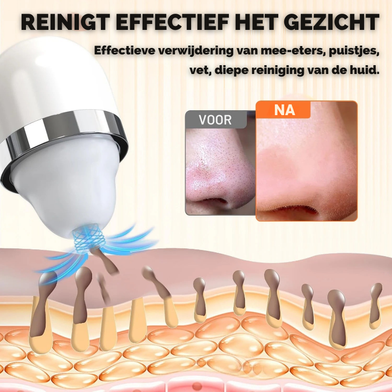 DermaVac - Zeg vaarwel tegen mee-eters
